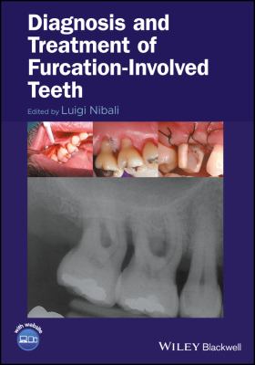 Diagnosis and Treatment of Furcation-Involved Teeth