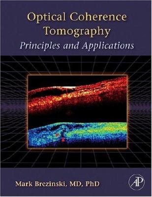 Optical Coherence Tomography : Principles and Applications