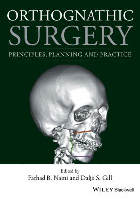 Orthognathic Surgery : Principles, Planning and Practice