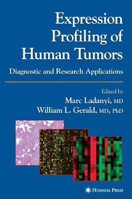Expression Profiling of Human Tumors : Diagnostic and Research Applications