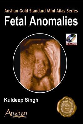 Fetal Anomalies