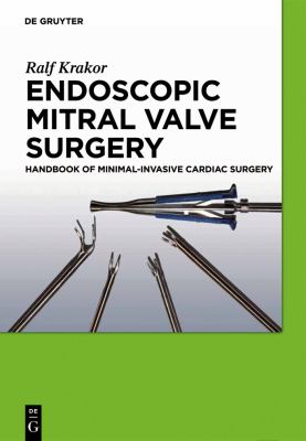 Endoscopic Mitral Valve Surgery : Handbook of Minimal-Invasive Cardiac Surgery