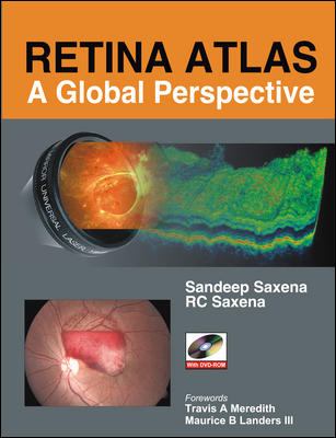 Retina Atlas - A Global Perspective