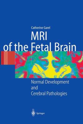 MRI of the Fetal Brain : Normal Development and Cerebral Pathologies