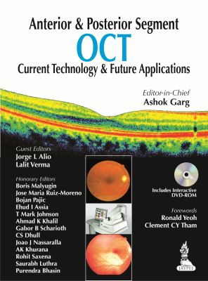 Anterior and Posterior Segment Oct : Current Technology and Future Applications