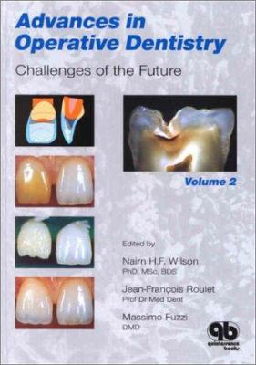 Advances in Operative Dentistry Vol. 2 : Challenges of the Future