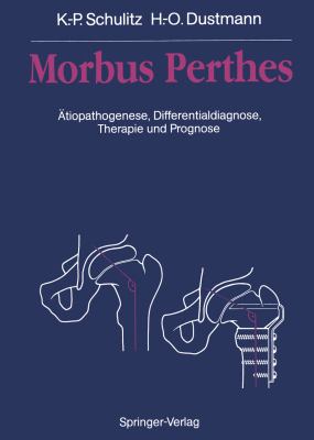Morbus Perthes : Ätiopathogenese, Differentialdiagnose, Therapie und Prognose