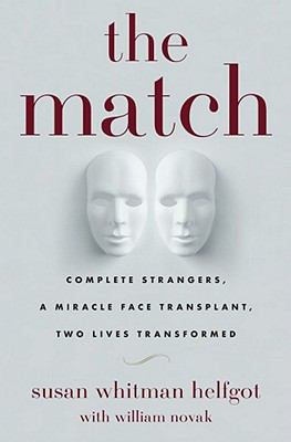 The Match : Complete Strangers, a Miracle Face Transplant, Two Lives Transformed