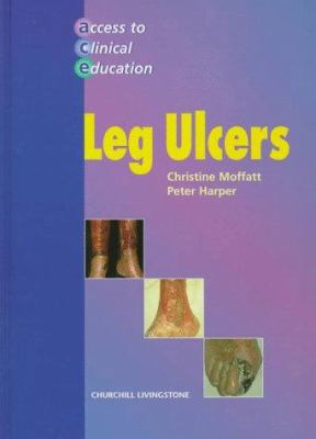 Leg Ulcers
