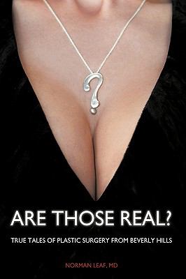 Are Those Real? : True Tales of Plastic Surgery from Beverly Hills