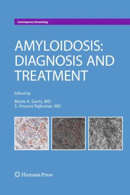 Amyloidosis : Diagnosis and Treatment