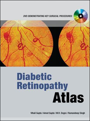 Diabetic Retinopathy Atlas