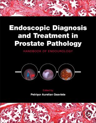 Endoscopic Diagnosis and Treatment in Prostate Pathology : Handbook of Endourology