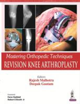 Knee Arthroplasty