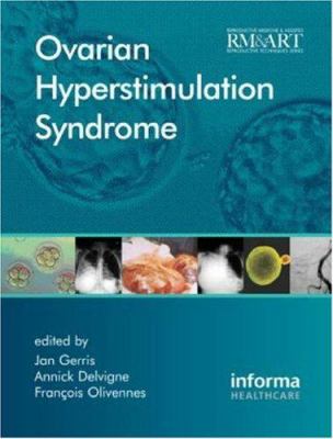 Ovarian Hyperstimulation Syndrome