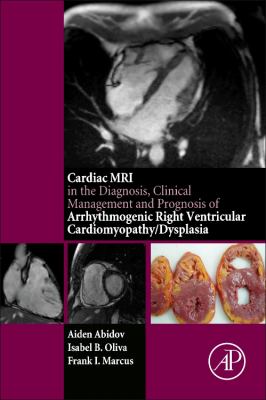 Cardiac MRI in the Diagnosis, Clinical Management and Prognosis of Arrythmogenic Right Ventricular Cardiomyopathy/Dysplasia