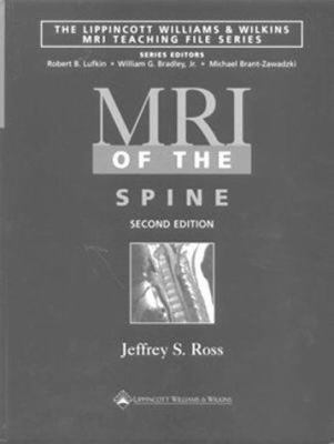 MRI of the Spine