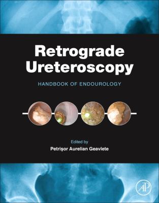 Retrograde Ureteroscopy : Handbook of Endourology
