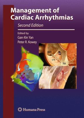 Management of Cardiac Arrhythmias