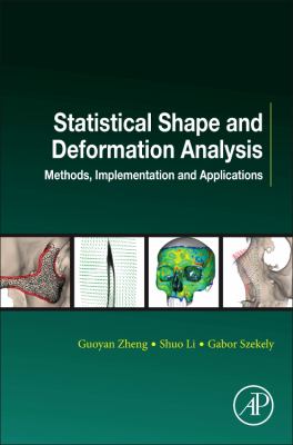 Statistical Shape and Deformation Analysis : Methods, Implementation and Applications