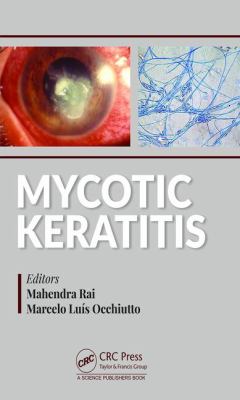 Mycotic Keratitis