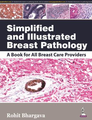 Simplified and Illustrated Breast Pathology : A Book for All Breast Care Providers