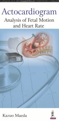 Actocardiogram : Analysis of Fetal Motion and Heart Rate