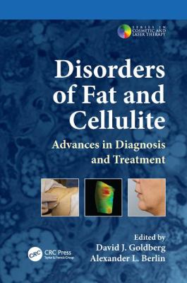 Disorders of Fat and Cellulite : Advances in Diagnosis and Treatment