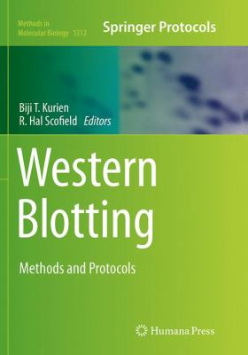 Western Blotting : Methods and Protocols