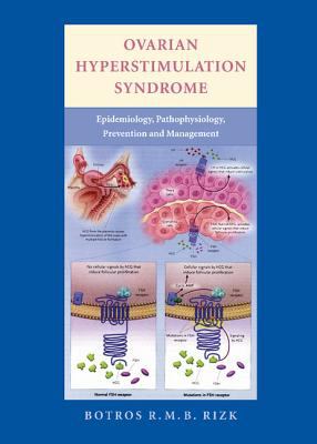 Ovarian Hyperstimulation Syndrome : Epidemiology, Pathophysiology, Prevention and Management