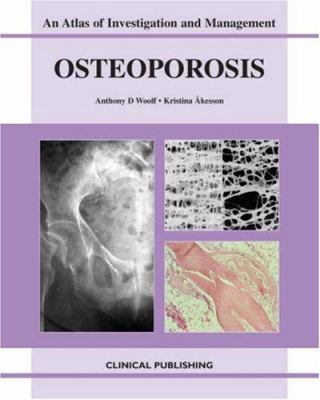 Osteoporosis : An Atlas of Investigation and Diagnosis