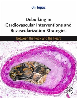 Debulking in Cardiovascular Interventions and Revascularization Strategies : Between a Rock and the Heart