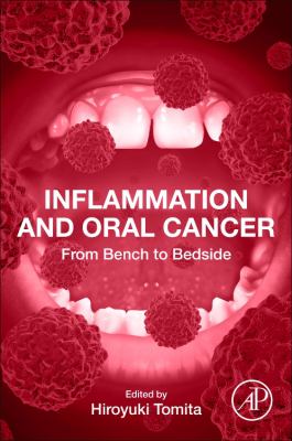 Inflammation and Oral Cancer : From Bench to Bedside