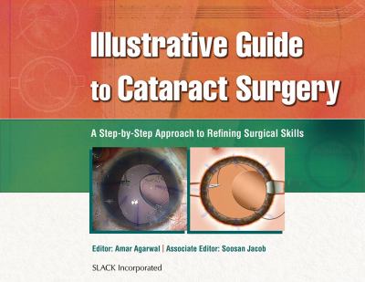 Illustrative Guide to Cataract Surgery : A Step-by-Step Approach to Refining Surgical Skills