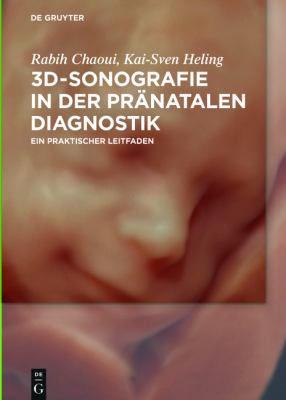 3D-SONOGRAFIE IN DER PRÄNATALEN DIAGNOSTIK : EIN PRAKTISCHER LEITFADEN