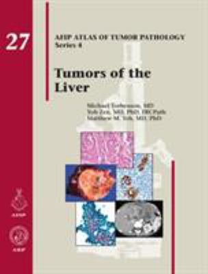 Tumors of the Liver