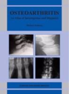 Oesteoarthritis : An Atlas of Investigation and Diagnosis
