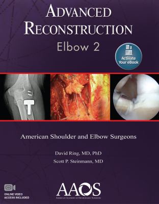 Elbow 2