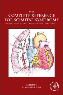 The Complete Reference for Scimitar Syndrome : Anatomy, Epidemiology, Diagnosis and Treatment