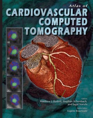 Atlas of Cardiovascular Computed Tomography