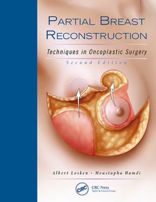 Partial Breast Reconstruction : Techniques in Oncoplastic Surgery