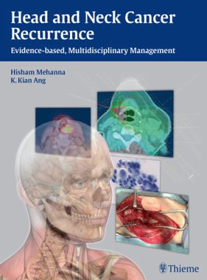 Head and Neck Cancer Recurrence : Evidence-Based, Multidisciplinary Management
