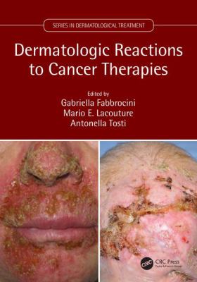Skin Reactions to Cancer Chemotherapy
