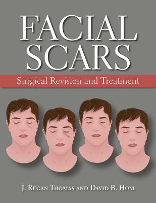Facial Scars : Surgical Revision and Treatment