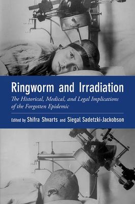 Ringworm and Irradiation : The Historical, Medical, and Legal Implications of the Forgotten Epidemic