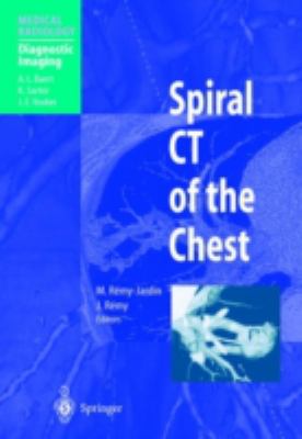 Spiral CT of the Chest