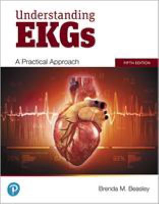 Understanding EKGs: a Practical Approach