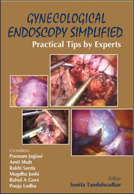 Gynecological Endoscopy Simplified : Practical Tips by Experts
