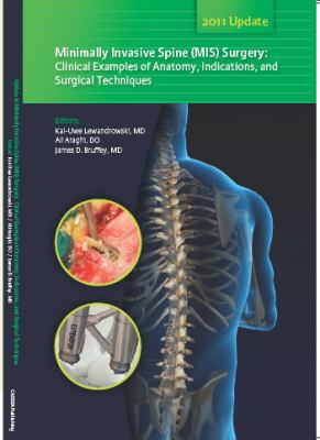 Update in minimally invasive spine (mis) Surgery : Clinical Examples of Anatomy, Indications, and Surgical Techniques