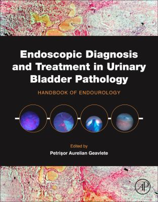 Endoscopic Diagnosis and Treatment in Urinary Bladder Pathology : Handbook of Endourology